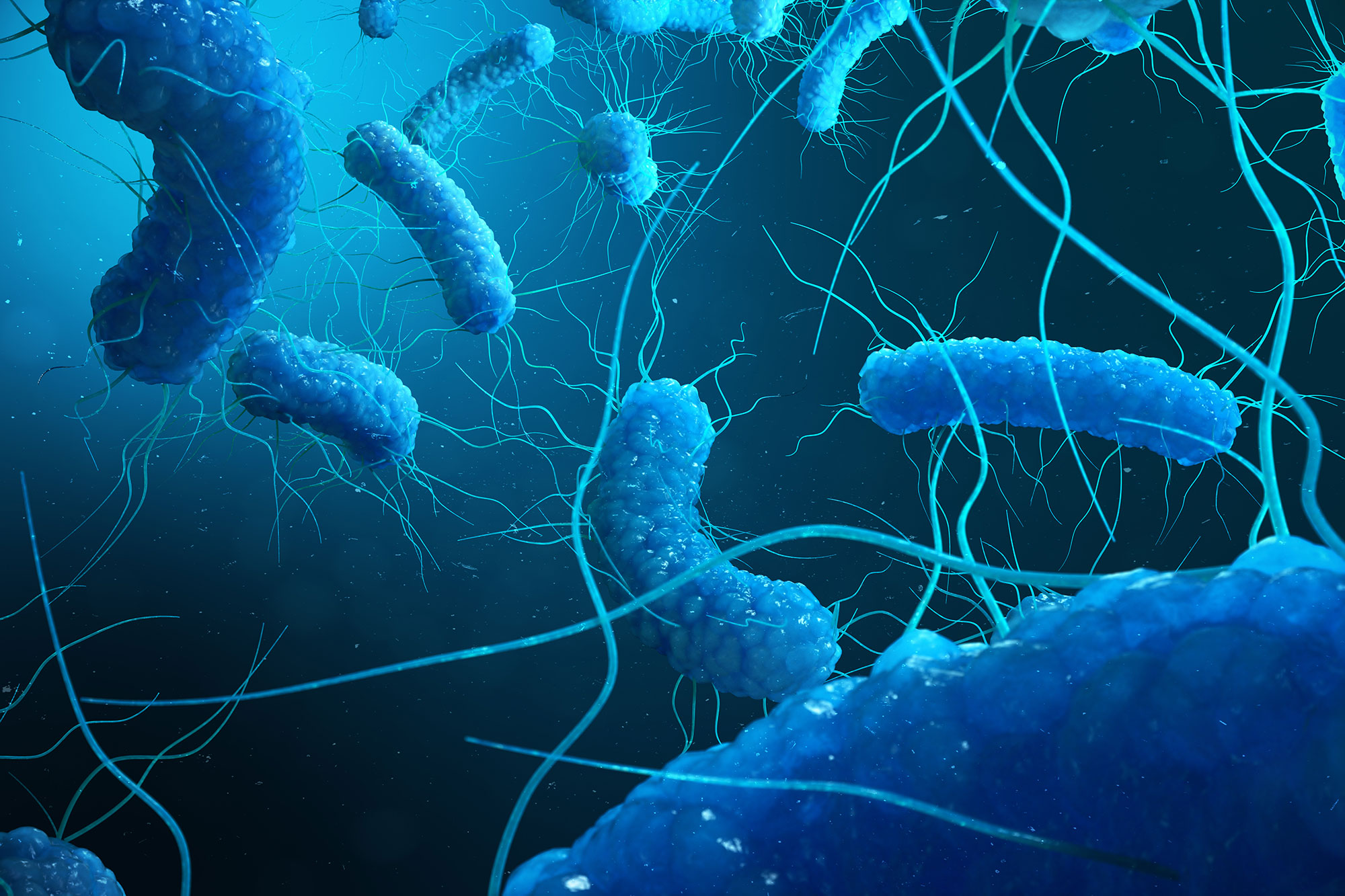 Delaying Legionella prevention adds to public health risk, says Swiftclean
